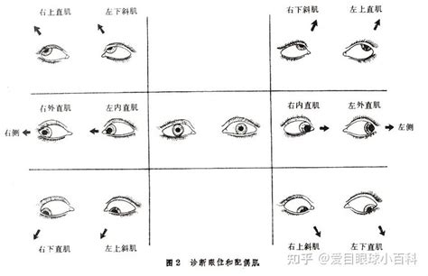 斜看|斜视的几种检查方法！